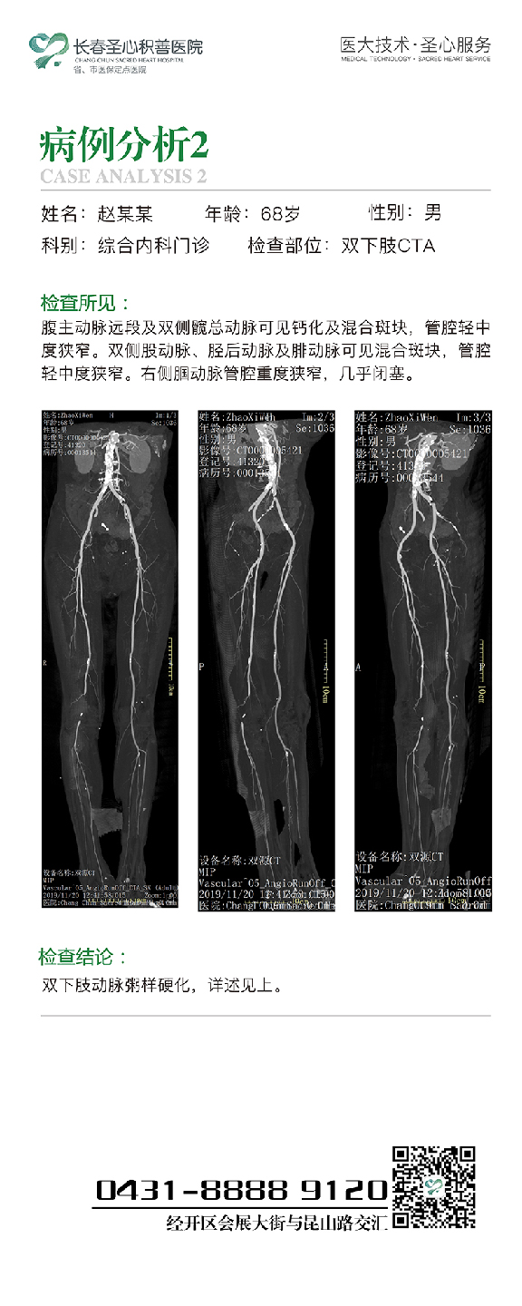 病例2.jpg