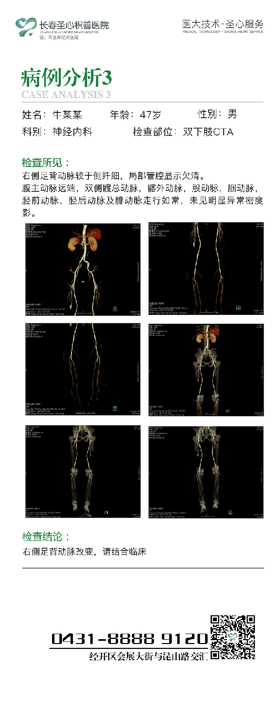 病例3.jpg