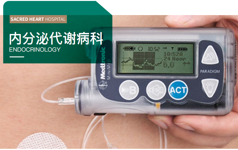 【内分泌代谢病科】智能动态“双C”疗法，科学控糖，最大程度摆脱胰岛素依赖