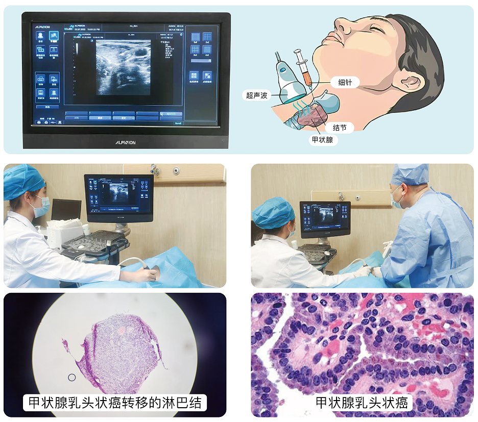 【专家出诊】甲状腺外科，国家级专家教授定期出诊、会诊