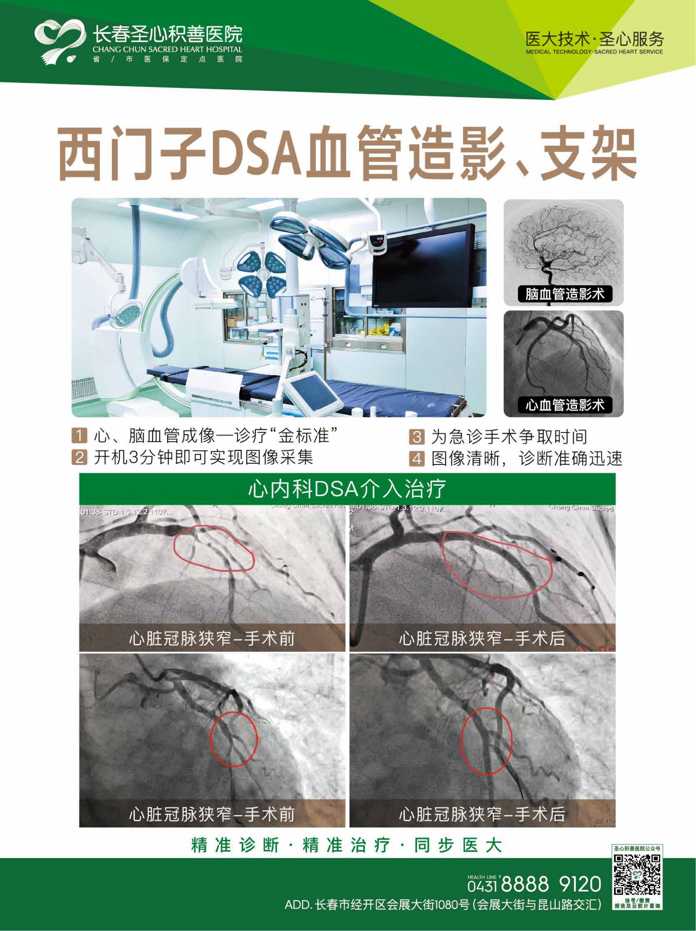 西门子DSA血管造影、支架2.jpg
