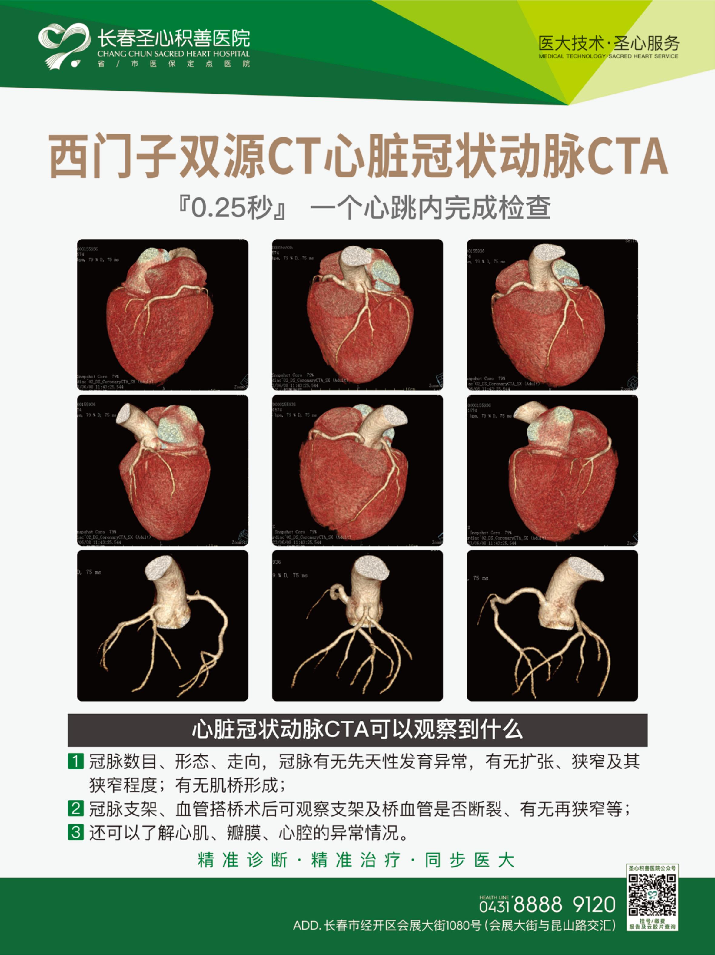 西门子双源CT  2.jpg