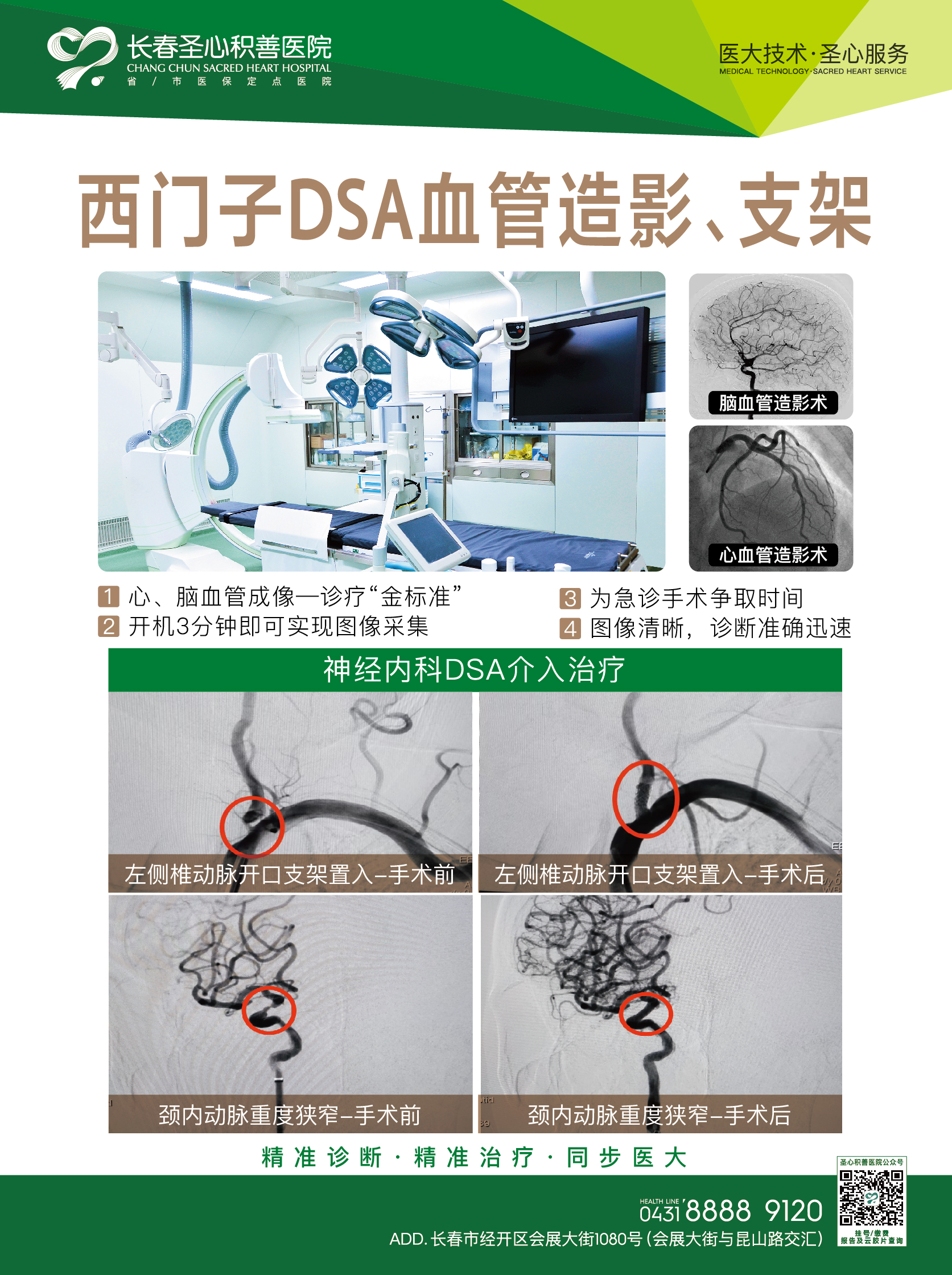 西门子DSA血管造影、支架1.jpg
