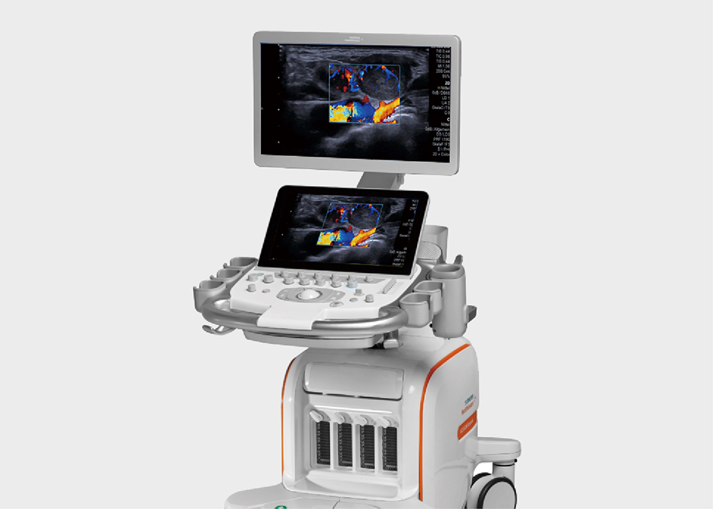 西门子超声诊断系统